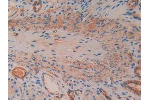 IHC-P analysis of Rat Stomach Tissue, with DAB staining. (SMAD1 anticorps  (AA 273-468))