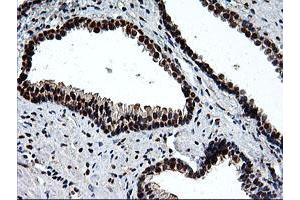 Image no. 1 for anti-EPM2A (Laforin) Interacting Protein 1 (EPM2AIP1) antibody (ABIN1498046) (EPM2AIP1 anticorps)