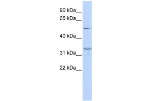 WB Suggested Anti-ZNF765 Antibody Titration:  0. (ZNF765 anticorps  (Middle Region))
