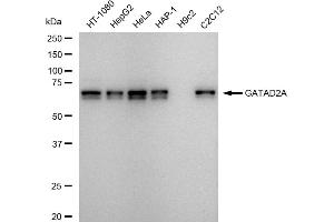 Western blotting analysis using GATAD2A antibody (ABIN7798698). (Recombinant GATAD2A anticorps)