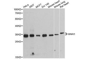 Western blot analysis of extracts of various cell lines, using SNAI1 antibody. (SNAIL anticorps  (AA 1-264))