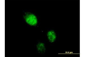 Immunofluorescence of purified MaxPab antibody to RAD23B on HeLa cell. (RAD23B anticorps  (AA 1-409))