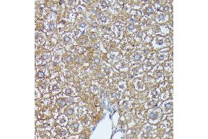 Immunohistochemistry of paraffin-embedded mouse liver using C2 Rabbit pAb (ABIN7265549) at dilution of 1:100 (40x lens).