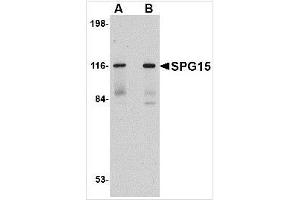 Western blot analysis of SPG15 in rat heart tissue lysate with SPG15 antibody at (A) 0. (ZFYVE26 anticorps  (C-Term))