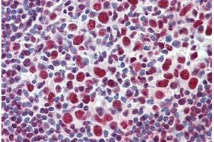 Human Tonsil: Formalin-Fixed, Paraffin-Embedded (FFPE)