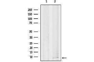 Western blot analysis of lysates from EC304 cells, using Ribosomal Protein S29 Antibody.