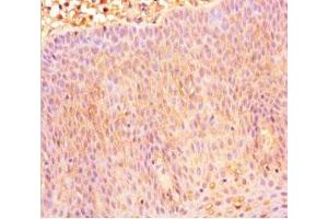 Immunohistochemistry of paraffin-embedded human tonsil tissue using ABIN7146107 at dilution of 1:100