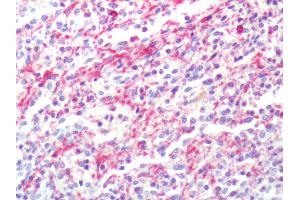 Human Spleen: Formalin-Fixed, Paraffin-Embedded (FFPE)