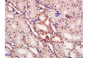 Formalin-fixed and paraffin embedded rat kidney tissue labeled with Anti-CTBP1 (Ser422) Polyclonal Antibody, Unconjugated  at 1:300 followed by conjugation to the secondary antibody and DAB staining.