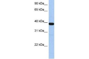 ZNF781 anticorps