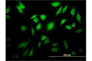 Immunofluorescence of monoclonal antibody to TESK2 on HeLa cell. (TESK2 anticorps  (AA 405-542))