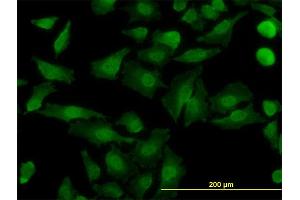 Immunofluorescence of monoclonal antibody to NDE1 on HeLa cell. (NDE1 anticorps  (AA 1-335))