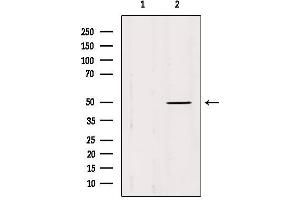 Western blot analysis of extracts from Mouse brain, using IFT52 Antibody. (IFT52 anticorps  (Internal Region))
