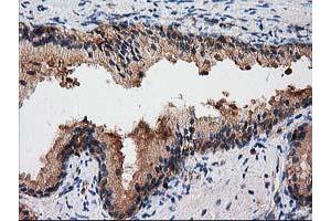 Image no. 1 for anti-Gephyrin (GPHN) antibody (ABIN1498424)