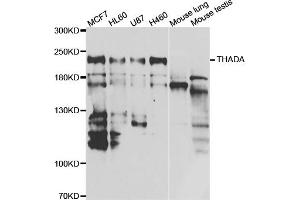 Western blot analysis of extracts of various cell lines, using THADA antibody. (THADA anticorps)