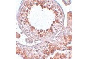 anti-ESX Homeobox 1 (ESX1) (Center) antibody