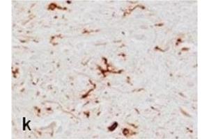 Anterior horn of the spinal cord.