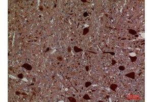 Immunohistochemistry (IHC) analysis of paraffin-embedded Rat Brain, antibody was diluted at 1:100. (Hexosaminidase A anticorps  (Internal Region))