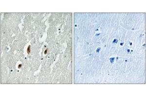 Immunohistochemistry analysis of paraffin-embedded human brain tissue, using SRF (Ab-77) Antibody. (SRF anticorps  (AA 41-90))