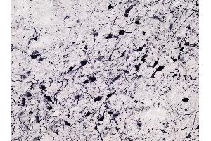 ABIN570916 immunostaining of dopaminergic neurons in cryosection of an immersion-fixed (4% PFA) human hypothalamus. (Tyrosine Hydroxylase anticorps  (C-Term))