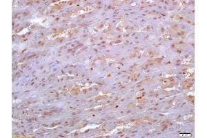 Formalin-fixed and paraffin embedded mouse stomach labeled with Anti-SDF4 Polyclonal Antibody, Unconjugated (ABIN720595) at 1:200 followed by conjugation to the secondary antibody and DAB staining (SDF4 anticorps  (AA 121-230))