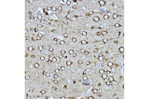 Immunohistochemistry of paraffin-embedded rat brain using [KO Validated] CRMP2/CRMP2/DPYSL2 Rabbit pAb (ABIN7266769) at dilution of 1:400 (40x lens).