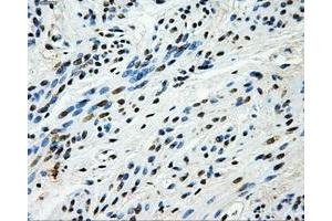 Immunohistochemical staining of paraffin-embedded endometrium tissue using anti-HK2mouse monoclonal antibody. (Hexokinase 2 anticorps)