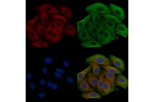 ABIN6259609 and ABIN6275532 staining Hela cells by IF/ICC. (NIM1 anticorps  (C-Term))