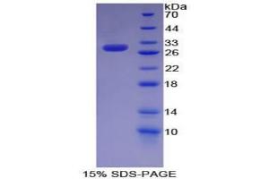 SDS-PAGE analysis of Mouse KHDRBS1 Protein. (KHDRBS1 Protéine)