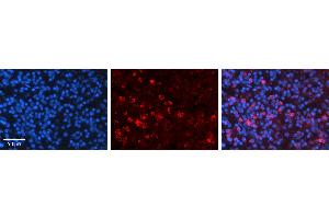 Rabbit Anti-CCNB1 Antibody   Formalin Fixed Paraffin Embedded Tissue: Human Lymph Node Tissue Observed Staining: Cytoplasm Primary Antibody Concentration: 1:600 Other Working Concentrations: N/A Secondary Antibody: Donkey anti-Rabbit-Cy3 Secondary Antibody Concentration: 1:200 Magnification: 20X Exposure Time: 0. (Cyclin B1 anticorps  (C-Term))