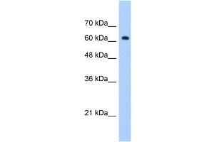 Human Jurkat; WB Suggested Anti-ZNF675 Antibody Titration: 1. (ZNF675 anticorps  (C-Term))