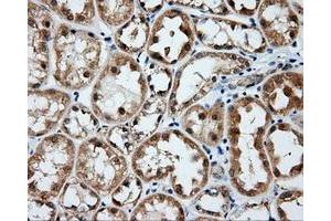 Immunohistochemical staining of paraffin-embedded Kidney tissue using anti-BTK mouse monoclonal antibody. (BTK anticorps)