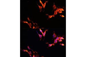 Immunofluorescence analysis of NIH-3T3 cells using L Polyclonal Antibody (ABIN6133274, ABIN6143083, ABIN6143084 and ABIN6215309) at dilution of 1:100 (40x lens). (LAMTOR1 anticorps  (AA 1-161))