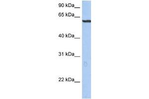 WB Suggested Anti-TRIM22 Antibody Titration: 0. (TRIM22 anticorps  (N-Term))