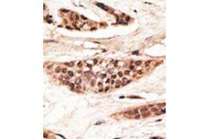 Image no. 1 for anti-Transporter 1, ATP-Binding Cassette, Sub-Family B (MDR/TAP) (TAP1) (AA 773-802), (C-Term) antibody (ABIN1449427)