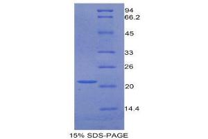 SDS-PAGE (SDS) image for Growth Arrest-Specific 6 (GAS6) (AA 483-646) protein (His tag) (ABIN1877320) (GAS6 Protein (AA 483-646) (His tag))
