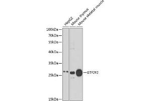 Western blot analysis of extracts of various cell lines, using GTF2F2 antibody (ABIN6131726, ABIN6141494, ABIN6141496 and ABIN6217519) at 1:1000 dilution.