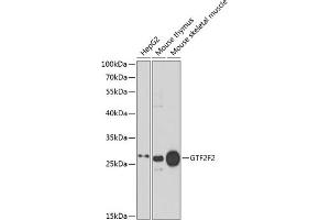 Western blot analysis of extracts of various cell lines, using GTF2F2 antibody (ABIN6131726, ABIN6141494, ABIN6141496 and ABIN6217519) at 1:1000 dilution. (GTF2F2 anticorps  (AA 1-249))