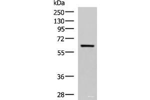 Western blot analysis of Human fetal brain tissue lysate using SARS Polyclonal Antibody at dilution of 1:850 (Seryl-tRNA Synthetase (SARS) anticorps)