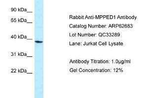 Western Blotting (WB) image for anti-metallophosphoesterase Domain Containing 1 (MPPED1) (Middle Region) antibody (ABIN2789208) (MPPED1 anticorps  (Middle Region))