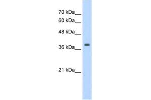 Western Blotting (WB) image for anti-Tropomyosin 1 (Alpha) (TPM1) antibody (ABIN2462395) (Tropomyosin anticorps)
