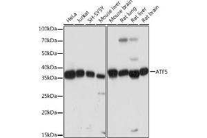Western blot analysis of extracts of various cell lines, using  Rabbit mAb (ABIN7265406) at 1:1000 dilution. (ATF5 anticorps)