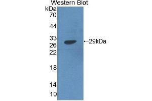 Detection of Recombinant HADH, Human using Polyclonal Antibody to Hydroxyacyl Coenzyme A Dehydrogenase (HADH) (HADH anticorps  (AA 1-236))