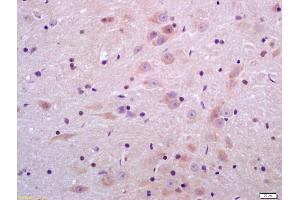 Formalin-fixed and paraffin embedded rat brain labeled with Anti-Sulfatase 2 Polyclonal Antibody, Unconjugated (ABIN750763) at 1:200 followed by conjugation to the secondary antibody and DAB staining (SULF2 anticorps  (AA 651-750))