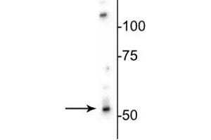 Western blot of rat brain lysate showing specific immunolabeling of the ~53 kDa β3-subunit of the GABAA-R. (GABRB3 anticorps  (Cytoplasmic Loop))