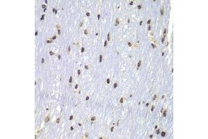 Immunohistochemistry of paraffin-embedded mouse brain using Lyn antibody (ABIN4904272) at dilution of 1:100 (40x lens). (LYN anticorps)