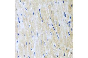 Immunohistochemistry of paraffin-embedded mouse heart using ITPKB antibody at dilution of 1:100 (x40 lens).