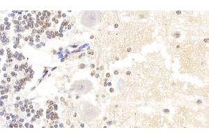 Detection of HIST2H3A in Human Cerebellum Tissue using Polyclonal Antibody to Histone Cluster 2, H3a (HIST2H3A) (HIST2H3A anticorps  (AA 1-136))
