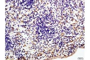 Formalin-fixed and paraffin embedded rat spleen labeled with Rabbit Anti-NFKB p65 Polyclonal Antibody, Unconjugated  at 1:200 followed by conjugation to the secondary antibody and DAB staining