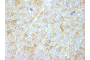 Immunohistochemistry (IHC) image for anti-Fatty Acid Synthase (FASN) (AA 2462-2511) antibody (ABIN7448964) (Fatty Acid Synthase anticorps  (AA 2462-2511))